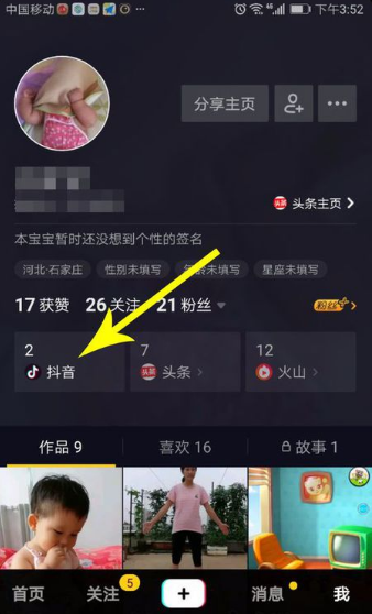 抖音怎么移除粉丝团成员？加人粉丝团的特权有哪些？