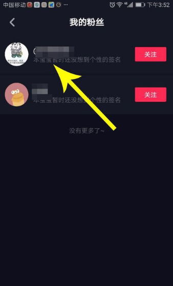 抖音怎么移除粉丝团成员？加人粉丝团的特权有哪些？