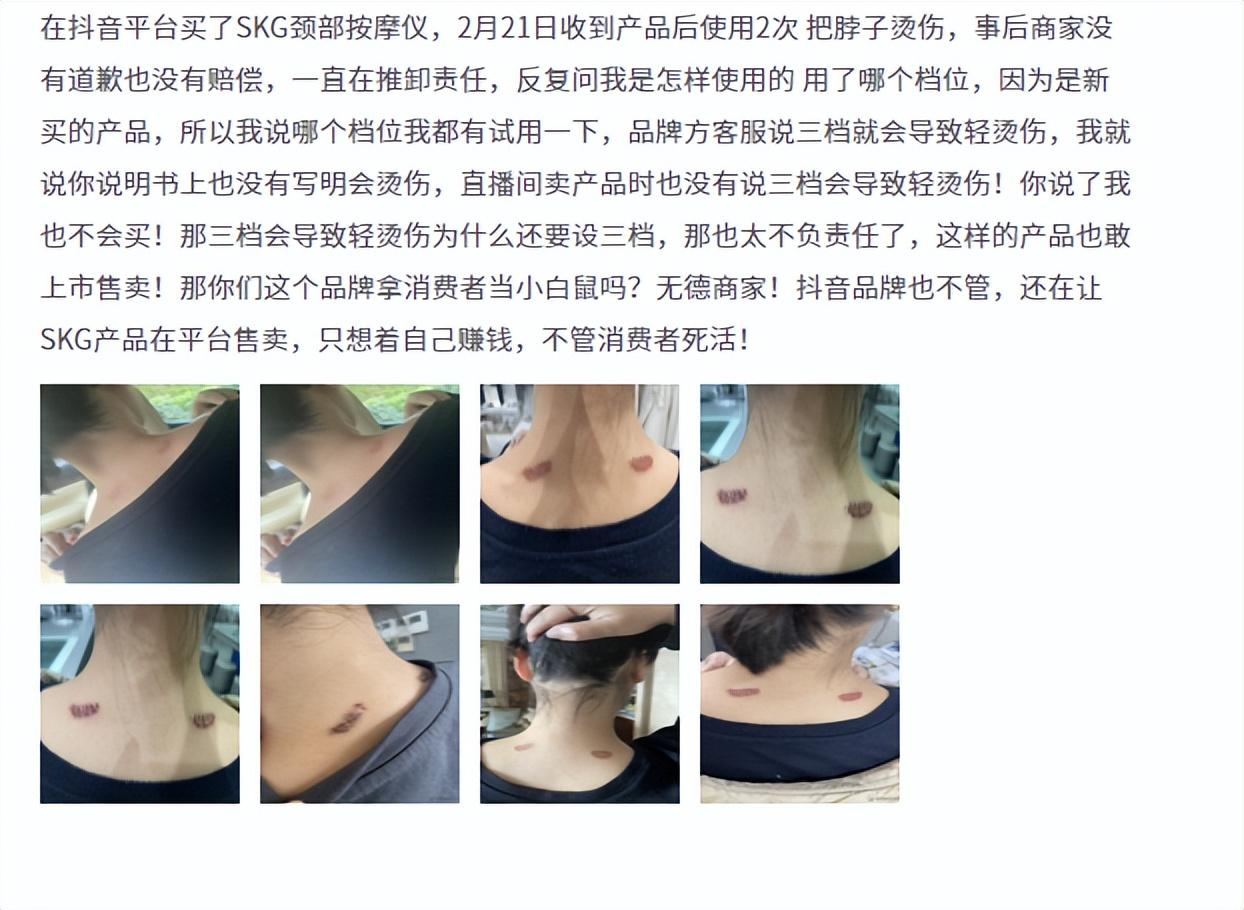 skg是哪个国家的品牌？SKG按摩仪产品问题堪忧成年轻人智商税？